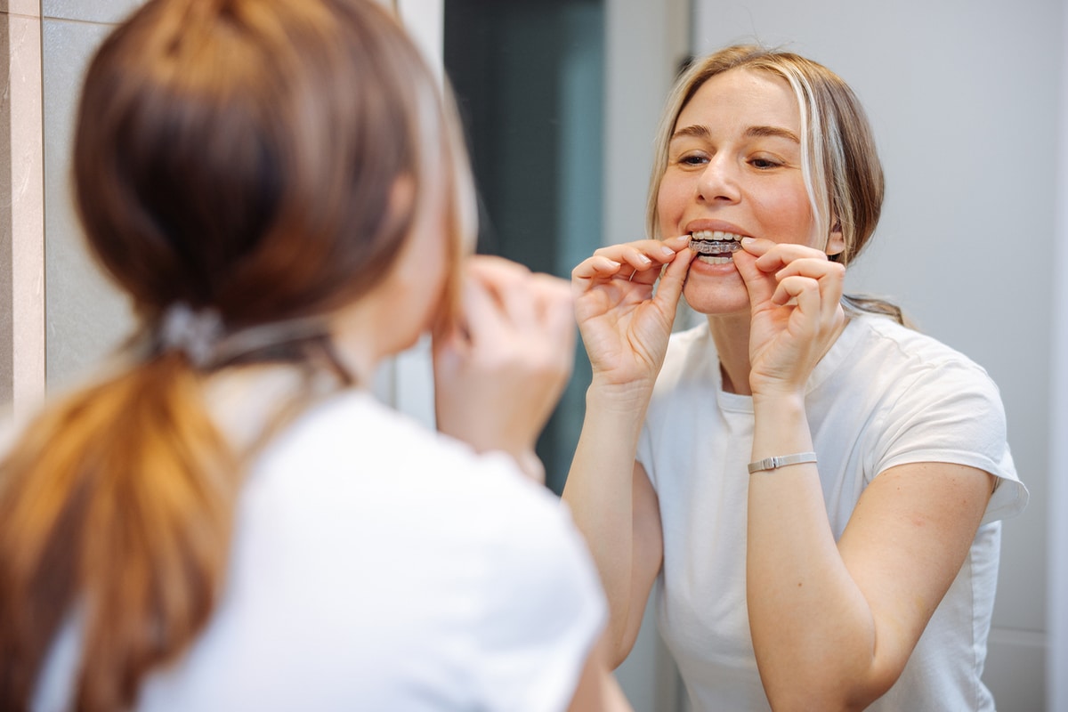 Damon braces for adults a discreet option without elastic ties blog