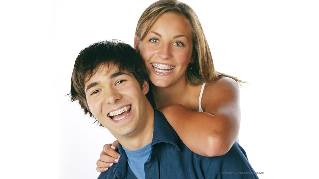 Damon metal braces photo