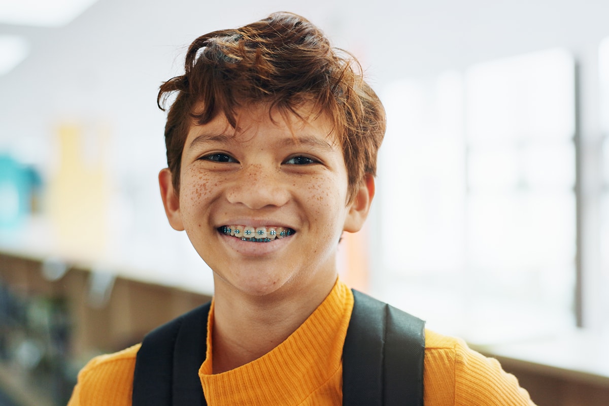 Early orthodontic warning signs parents should watch for ages 68 blog