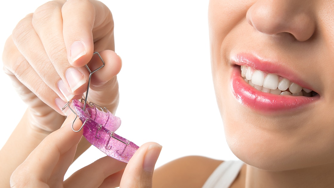 Expander photo