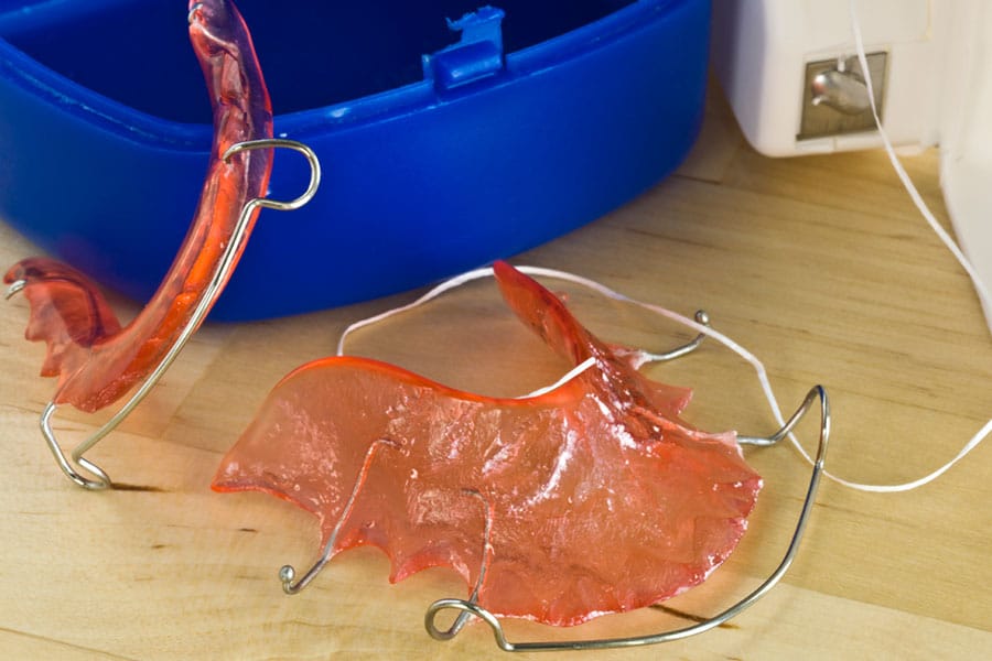 Hawley retainer photo