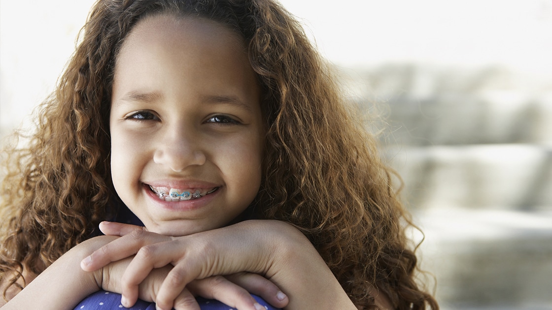 Interceptive orthodontic photo