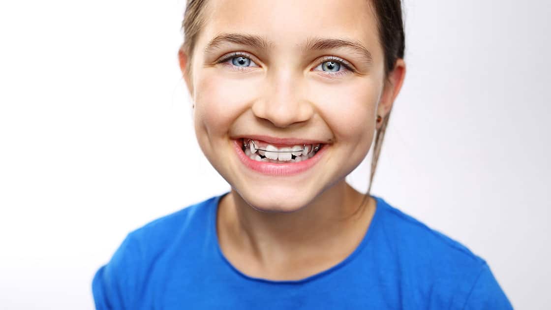 Interceptive orthodontics image 1