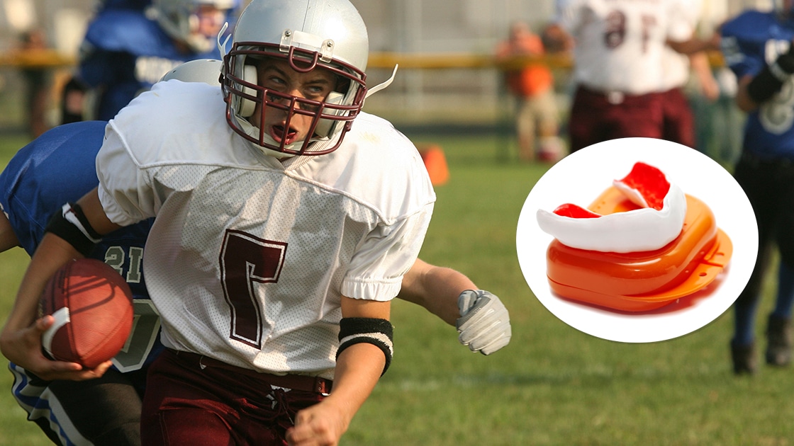 New mouthguard photo