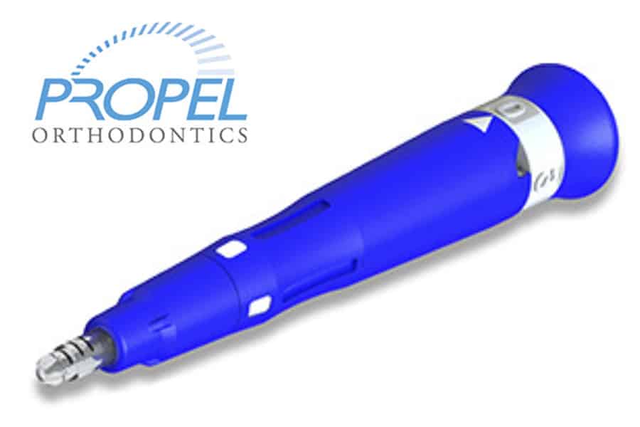 Tooth movement technology photo